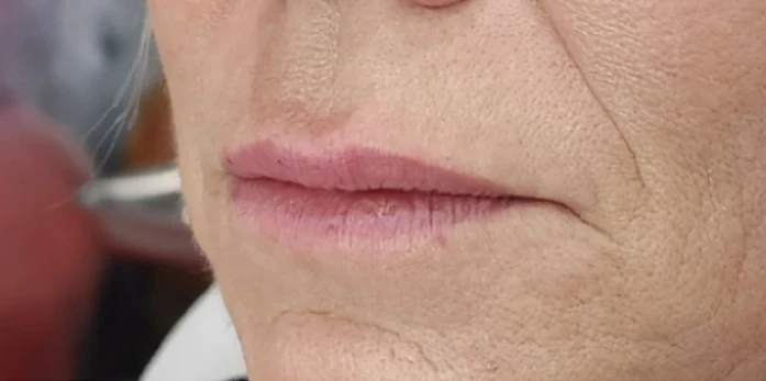 Close-up of an older person's lips and lower face, showcasing graceful wrinkles complemented by light pink lipstick, subtly suggesting a touch of filler for a timeless appeal.