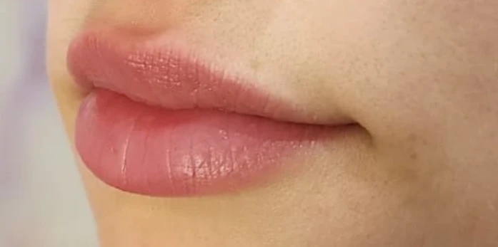 Close-up of a person's lips with a neutral expression, showing smooth skin and natural pink lip color—subtle results that can be achieved with expertly applied Botox and filler.